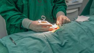 地方新闻精选 | 安徽首例“戒酒芯片”植入手术完成 官方通报男子用弹弓打死西湖鸳鸯-uusu优素-乐高,模型,3d打印,编程